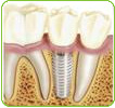 Equipo de Ciruga Implantolgica